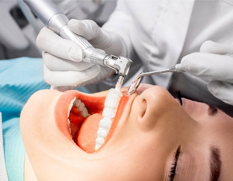 Teeth Cleaning In Toronto