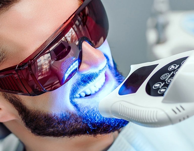 Zoom Whitening