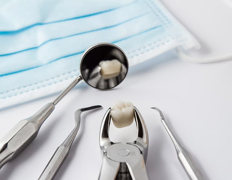 Tooth Extraction Near Toronto