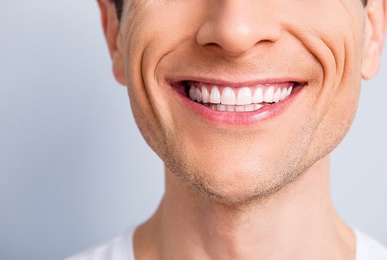 Cosmetic Dentistry Tooth Reshaping Toronto