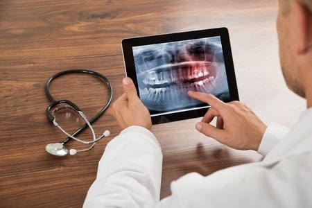 close-up of doctor looking at human teeth x-ray on the digital tablet