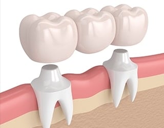 regrow teeth stem cells 