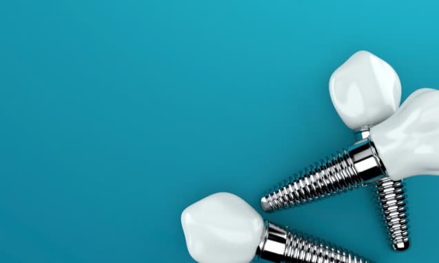 How Dental Implants Can Save Your Jaw