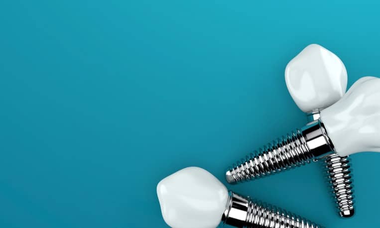 Dental implant