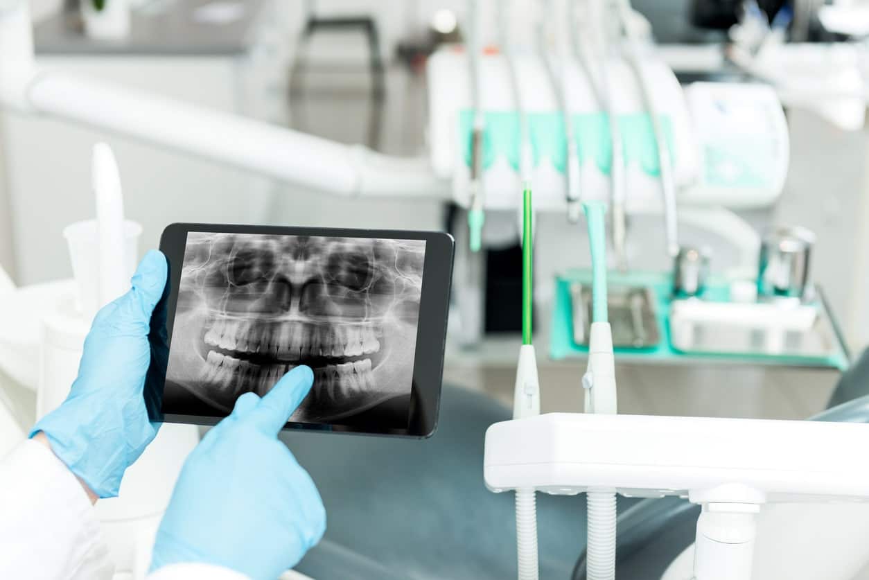 Dental radiogram on tablet