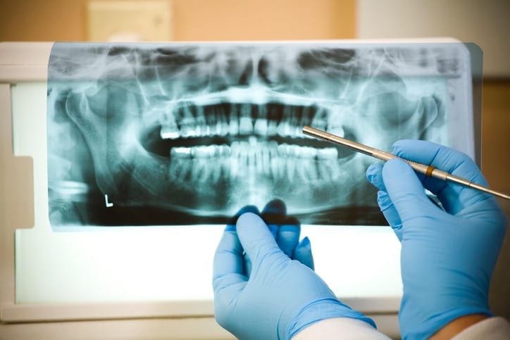 Dental X-Ray