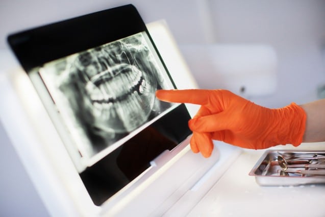 Why You Should Choose Our Dental Implants Clinic For Your Next Procedure