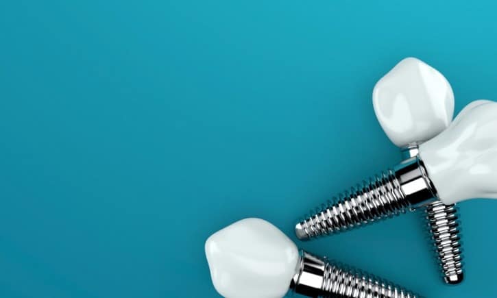 Dental implants