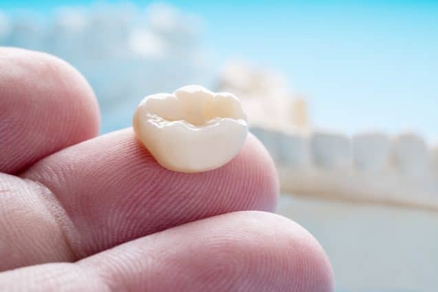 Dental Bridge VS Implant: What’s the Difference?