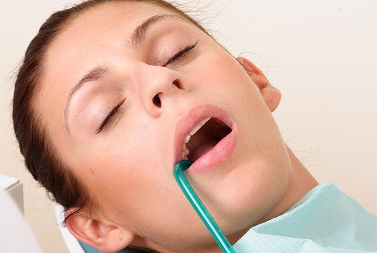 All On 4 Dental Implants Sleep Dentistry