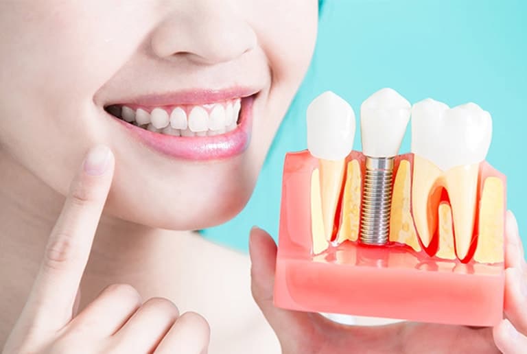 Cosmetic Dentistry Dental Implants Toronto