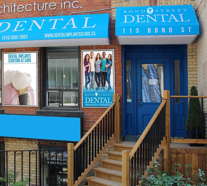 Bond street dental implants toronto thumbnail l