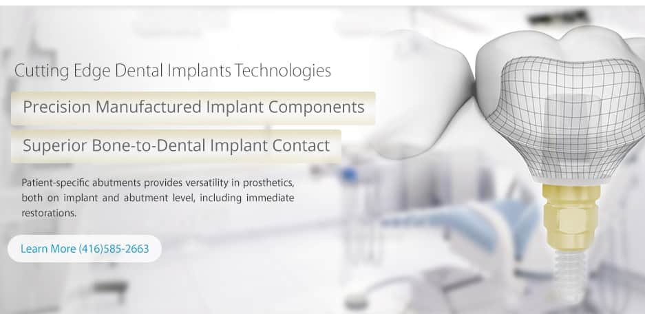 Dental implant components thumbnail l