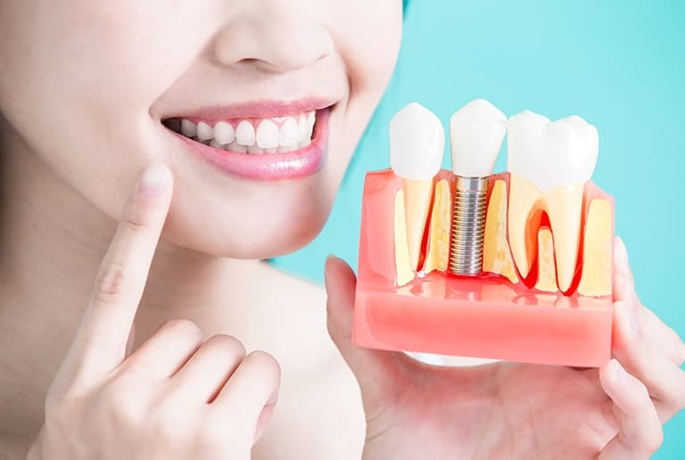 Dental Implants Toronto Oral Health