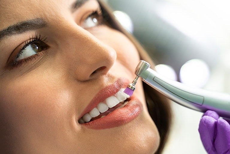 Dental Cleaning in Toronto 