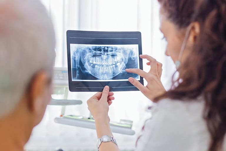 X-Ray cost for wisdom teeth removal