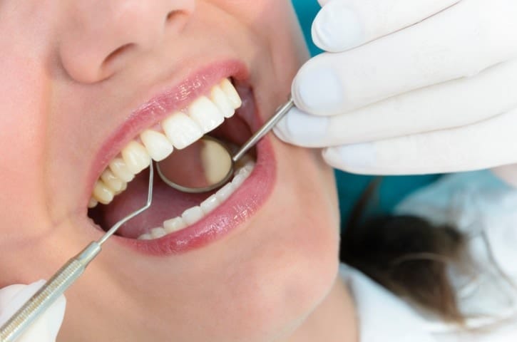 Dental Consultation