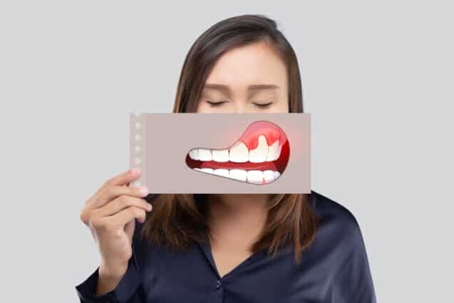 How Gum Disease Can Affect Chronic Conditions