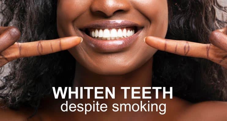 How To Maintain Whitened Teeth Despite Smoking
